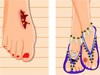 After Injury Pedicure A Free Dress-Up Game