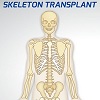 Skeleton Transplant A Free Education Game